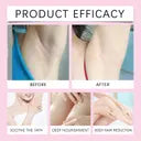 cyperus-rotundus-hair-removal-oil